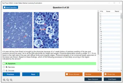 Test Prep USMLE United States Medical Licensing Examination Practice test exam simulator test engine exam Prep practice test questions answers Image 8